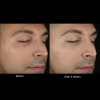 skinbetter science Solo Hydrating Defense™