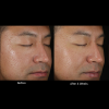 skinbetter science Solo Hydrating Defense™