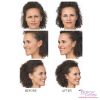 BOTOX® by the Area - Face (3 options)
