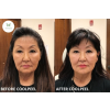 coolpeel_coolpeel_66128