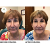 coolpeel_coolpeel_66129