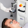 DEKA SmartXide Tetra Co2 laser resurfacing