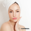 DEKA Laser