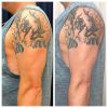 emsculpt_emsculpt_66298