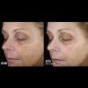 SkinBetter Even Tone Correcting Serum Before & After