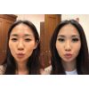 filler_filler_66003