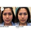 filler_filler_66004