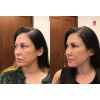 filler_filler_66005