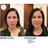 filler_filler_66016
