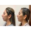 filler_filler_66027