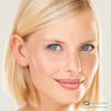 ProFractional® Laser Treatment