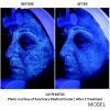 Halo™ Hybrid Fractional Laser (12 options)