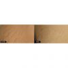 Fractional Laser Skin Resurfacing Fraxel 1540 Before & After