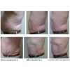 Futura Fit Program™ - Non-Surgical Fat Reduction and Inch Loss