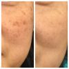 ipl_ipl_66188