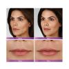 JUVÉDERM VOLBELLA® XC Before and After One