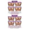 JUVÉDERM® Ultra Plus XC NOBD