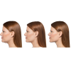 Kybella®
