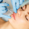 Revanesse® Lips™+