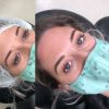Microblading Eyebrows
