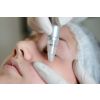 microderm facial