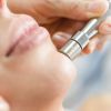 Microdermabrasion