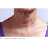 neckafter