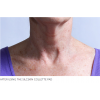 neckafter2