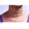 neckbefore