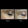 OxyGeneo® 3-in-1 Super Facial 