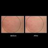 OxyGeneo® 3-in-1 Super Facial 