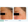 IPL Before and After 2