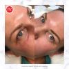 Microblading Eyebrows