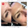 Microblading Eyebrows
