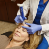 SkinPen® Microneedling