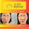 Ultra Refresh