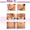 PRX Derm Perfexion