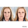 Sculptra® Aesthetic (no option)