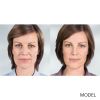 Sculptra® Aesthetic (no option)