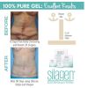 Silagen® Belly Button