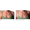 SilcSkin Decollette Pads
