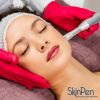 SkinPen® Microneedling