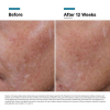 SkinCeuticals Hyaluronic Acid Intensifier Multi-Glycan