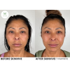 skinvive_skinvive_66133