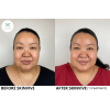 skinvive_skinvive_66135