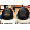 ted-hair-restoration_ted-hair-restoration_66138