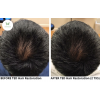 ted-hair-restoration_ted-hair-restoration_66141
