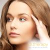 Ultherapy - Face Areas