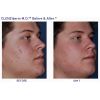 CLENZIderm B&A