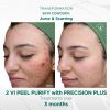 VI Peel Purify With Precision Plus - 4 Unit Box